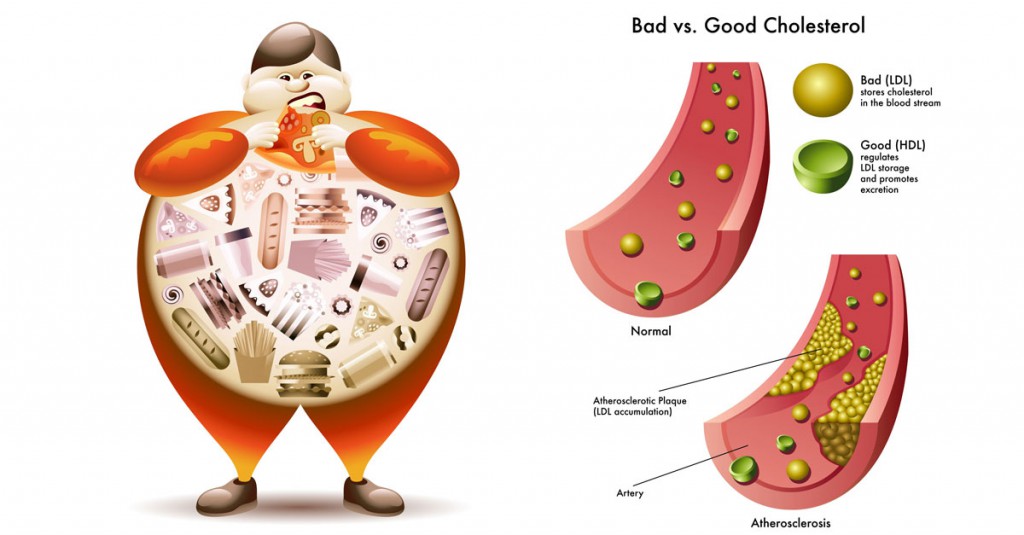 Good, Bad, and Ugly Cholesterol And How to Control It?