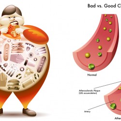 Good, Bad, and Ugly Cholesterol And How to Control It?